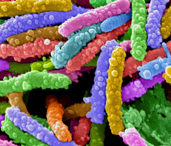 5 Hidden Contaminants Found in Well Water